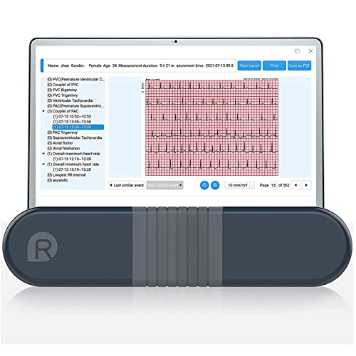 Wellue ECG Monitor, Professional Holter Recorder, 24h